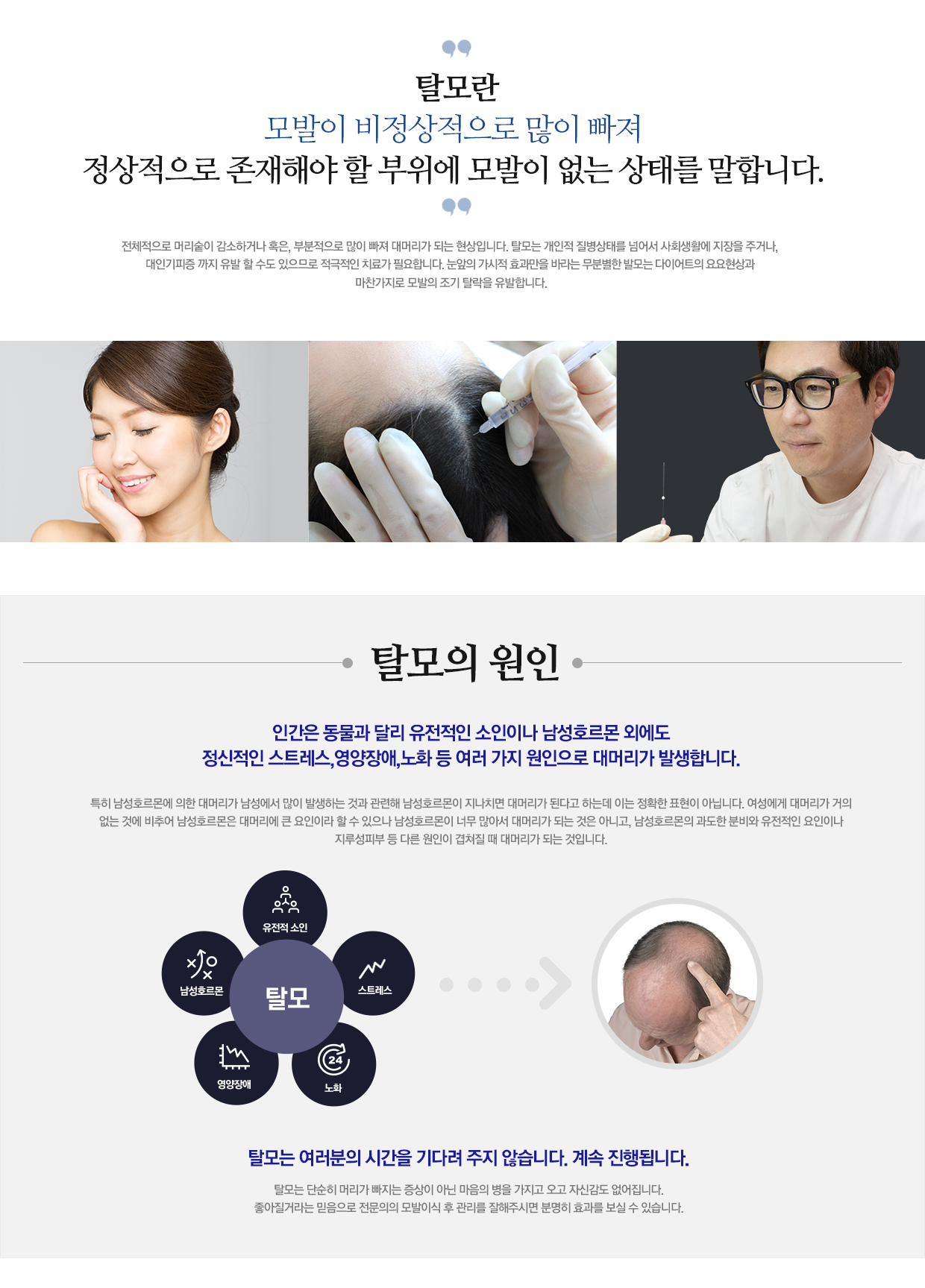 탈모의 원인