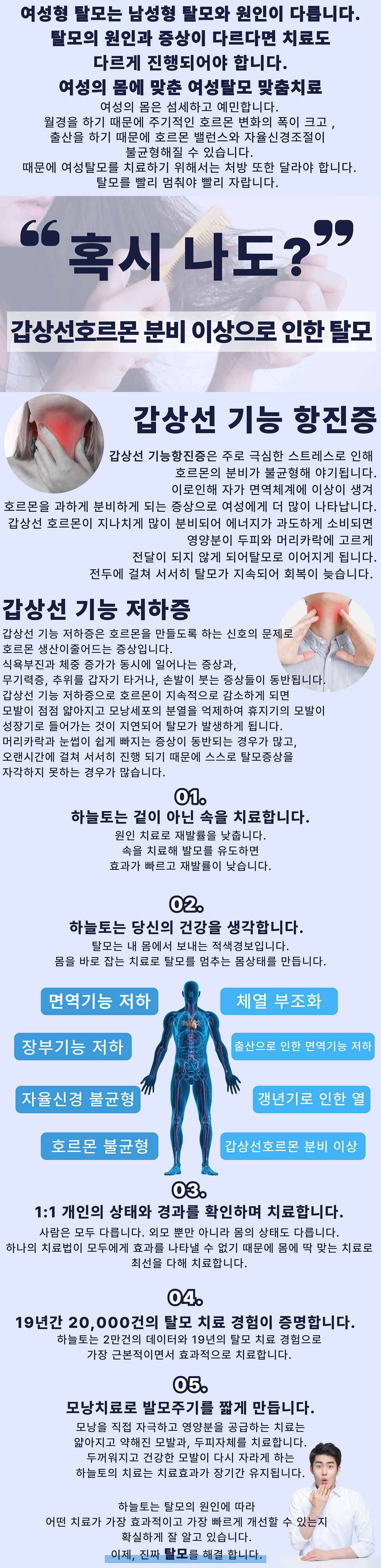여성형 탈모